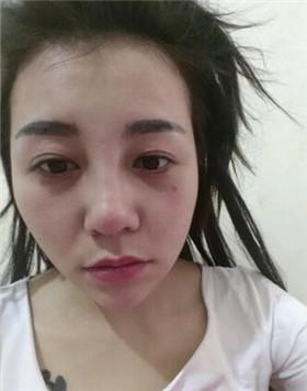 mk体育官网-人流与不孕症有什么关系人流术后护理怎么做(图3) mk体育