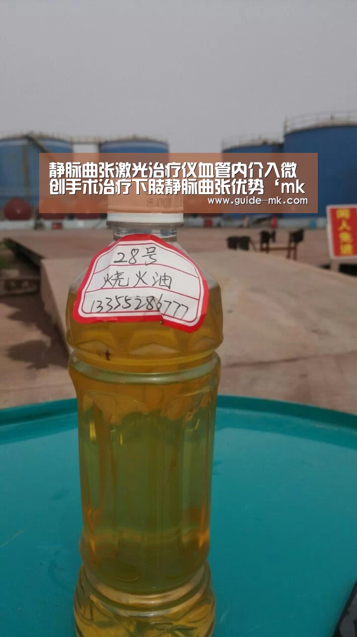 静脉曲张激光治疗仪血管内介入微创手术治疗下肢静脉曲张优势‘mk体育’(图1) mk体育入口
